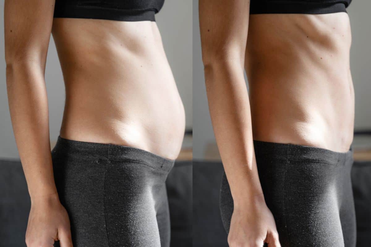 Post-Pregnancy: What Happens to Your Abdominal Muscles After Birth Harpenden