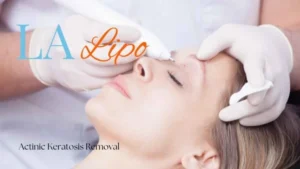 Woman receiving Actinic Keratosis Removal Treatment Harpenden