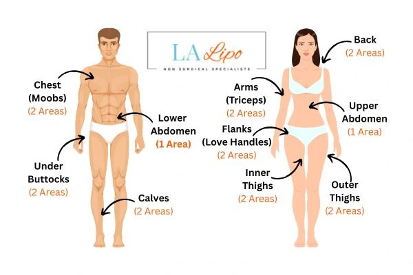 LA LIPO Cryolipolysis Areas Harpenden