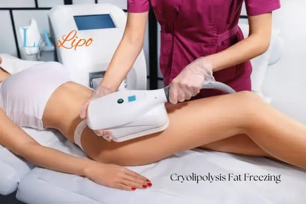 Woman receiving coolsculpting Harpenden treatment on her thighs