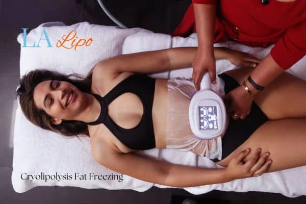 woman getting cryolipolysis Harpenden