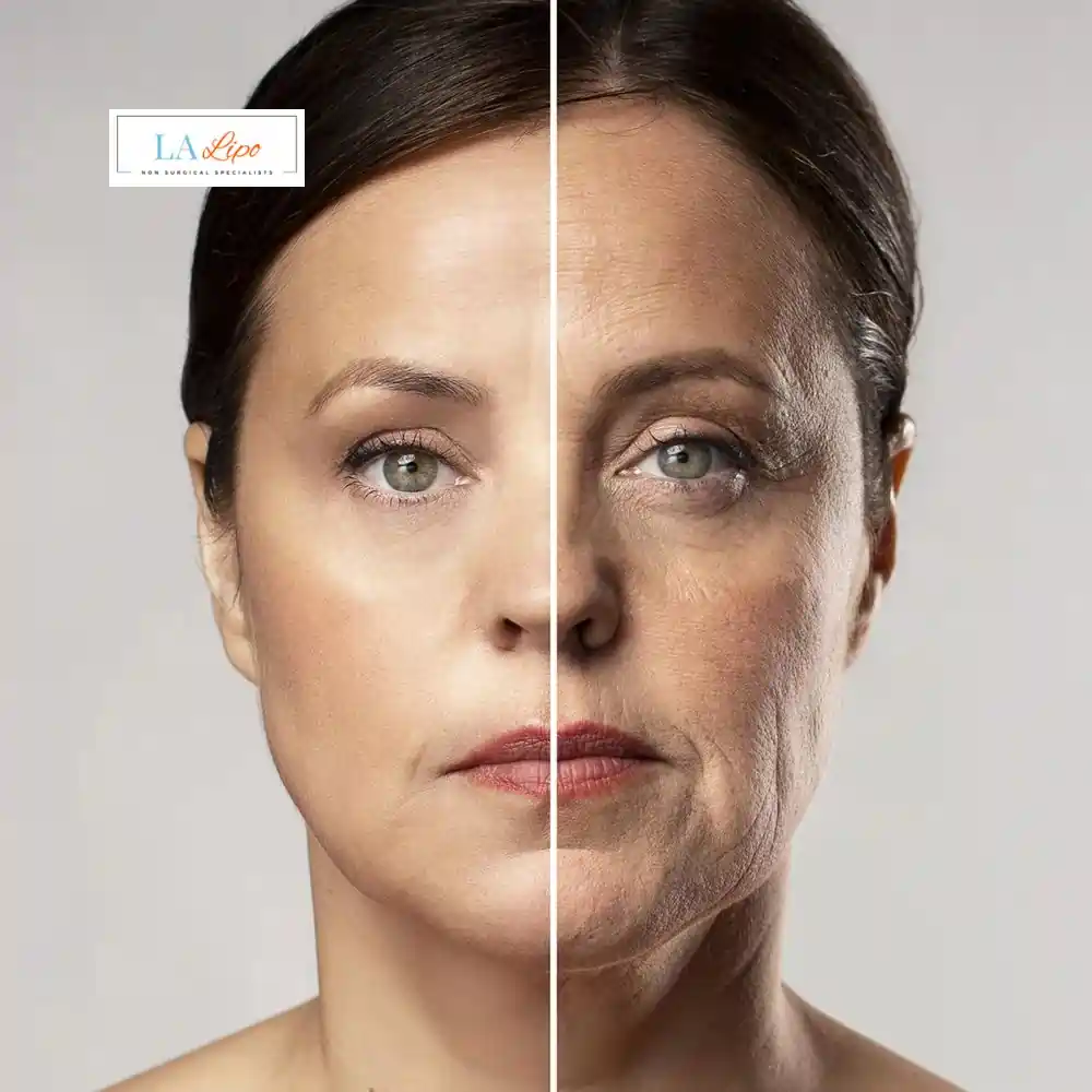 How Can You Tell If Non-Surgical Skin Tightening Is Right for You Harpenden?