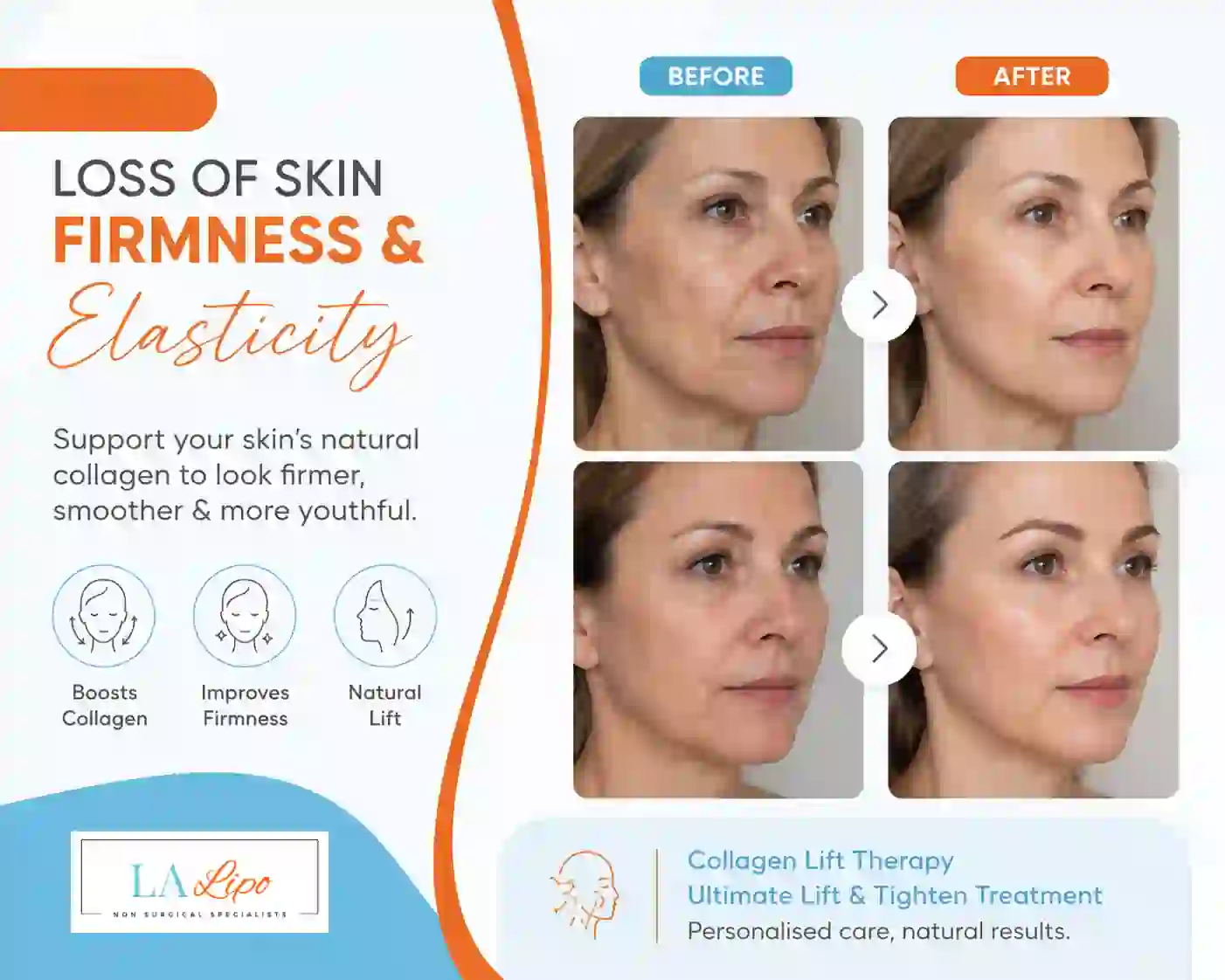 Sign #7: Loss of Skin Firmness and Elasticity Harpenden